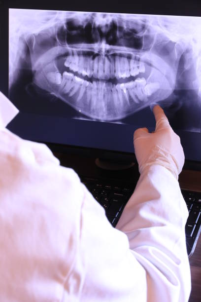 Best Broken or Chipped Tooth Repair in Port Edwards, WI